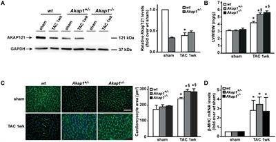 Loss of Akap1 Exacerbates Pressure Overload-Induced Cardiac Hypertrophy and Heart Failure